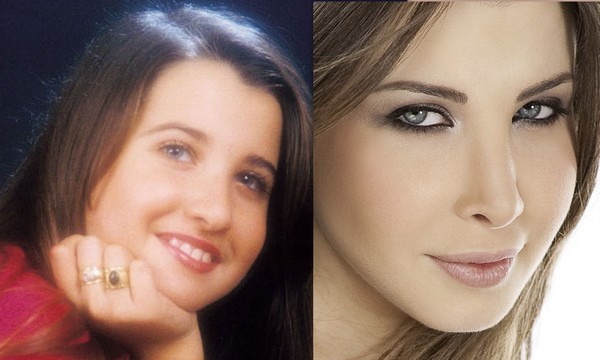 Arab Celebrities Before After